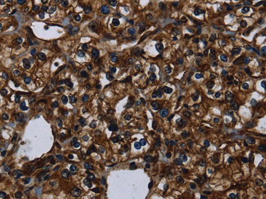 KLK14 Polyclonal Antibody Store at -20°C
