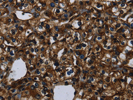 KLK14 Polyclonal Antibody Store at -20°C