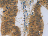 TNFRSF11B Polyclonal Antibody Store at -20°C