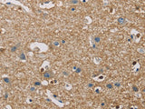 PIP4K2A Polyclonal Antibody Store at -20°C