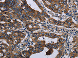 LZTFL1 Polyclonal Antibody Store at -20°C