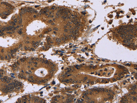 EDN2 Polyclonal Antibody Reactivity Human