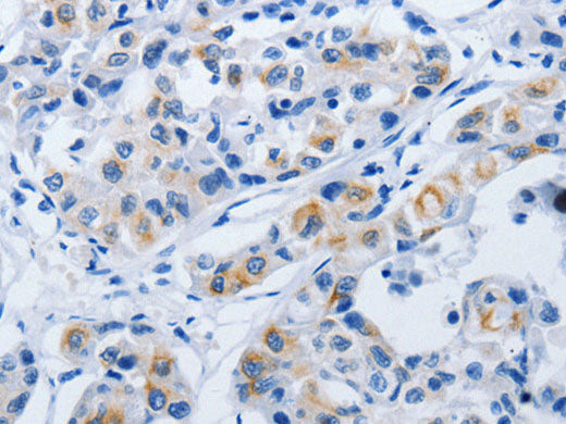 BPIFB3 Polyclonal Antibody Store at -20°C