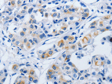 BPIFB3 Polyclonal Antibody Store at -20°C