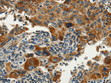 SERPINA9 Polyclonal Antibody Store at -20°C