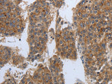 PDIA2 Polyclonal Antibody Store at -20°C