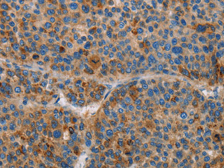 AMBP Polyclonal Antibody Store at -20°C