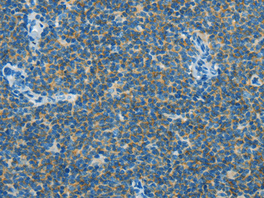 CAV3 Polyclonal Antibody Store at -20°C