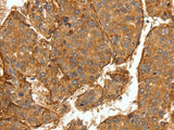 COL4A1 Polyclonal Antibody Store at -20°C