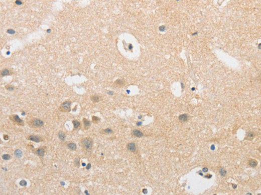 APLF Polyclonal Antibody Store at -20°C