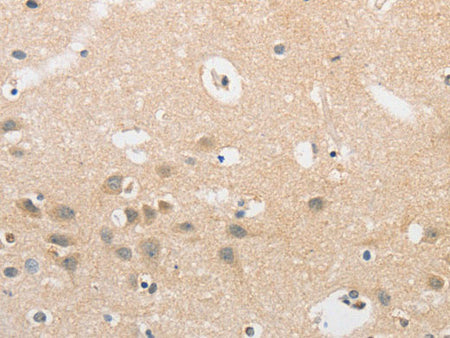 APLF Polyclonal Antibody Store at -20°C
