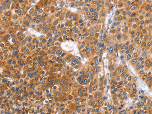 ABO Polyclonal Antibody Store at -20°C
