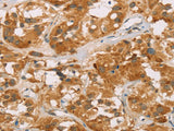 DLL4 Polyclonal Antibody Store at -20°C