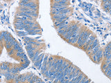 NCAPD2 Polyclonal Antibody Store at -20°C