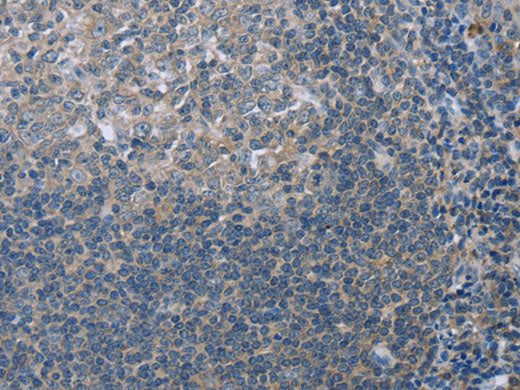 FAR2 Polyclonal Antibody