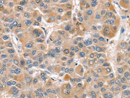CIAPIN1 Polyclonal Antibody Store at -20°C