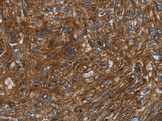 KISS1R Polyclonal Antibody Store at -20°C