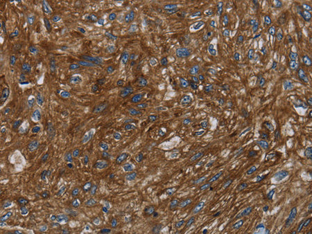 KISS1R Polyclonal Antibody Store at -20°C