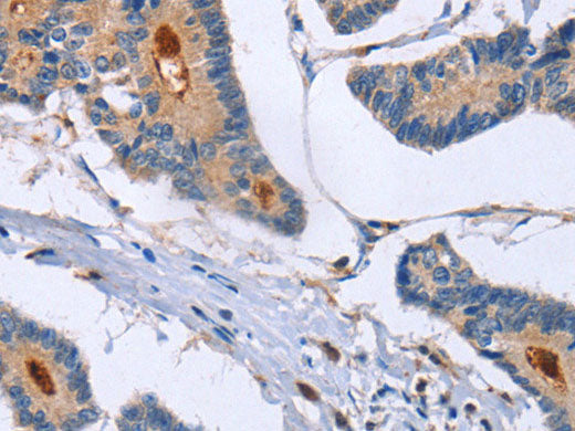 GMFG Polyclonal Antibody Store at -20°C