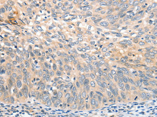 APTX Polyclonal Antibody 	Store at -20°C