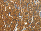 PTCH1 Polyclonal Antibody Reactivity Human, Mouse