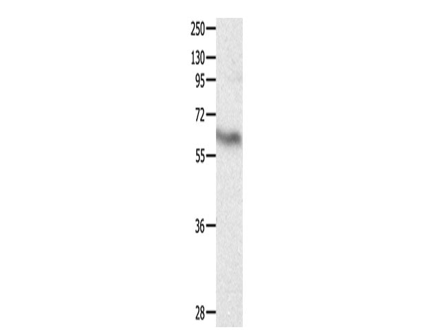 CRMP3 Polyclonal Antibody Store at -20°C