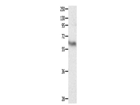 CRMP3 Polyclonal Antibody Store at -20°C