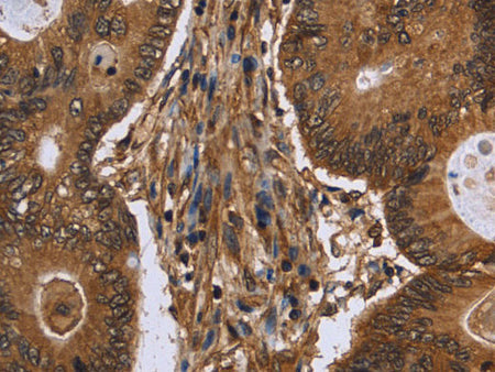 DCP1A Polyclonal Antibody Store at -20°C