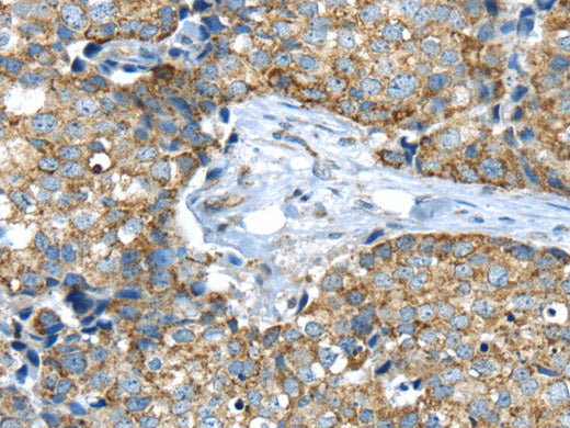 IFNA2 Polyclonal Antibody Store at -20°C
