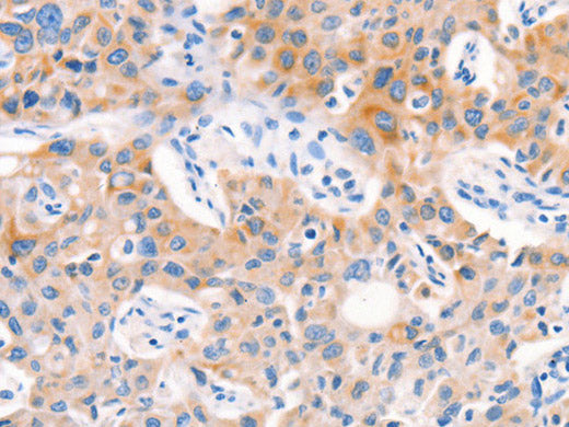 Factor XIIIa Polyclonal Antibody Store at -20°C