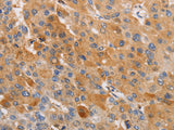 OLR1 Polyclonal Antibody