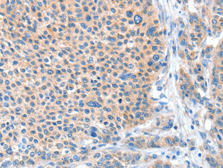 ADAM20 Polyclonal Antibody