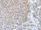 ADAM20 Polyclonal Antibody