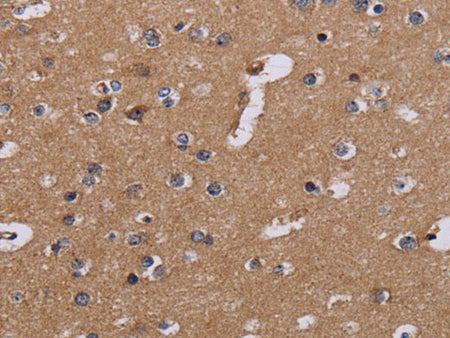 NDUFA1 Polyclonal Antibody