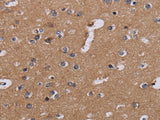 NDUFA1 Polyclonal Antibody