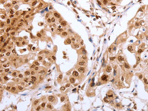 PTTG1 Polyclonal Antibody Store at -20°C