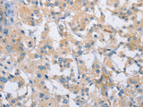CDCP1 Polyclonal Antibody