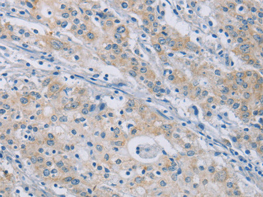 CERKL Polyclonal Antibody Store at -20°C