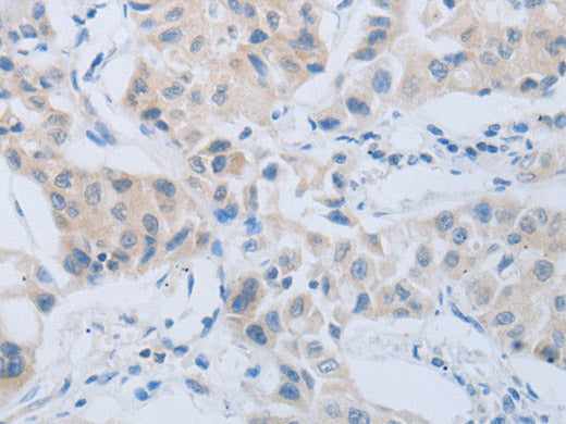CD10 Polyclonal Antibody Store at -20°C