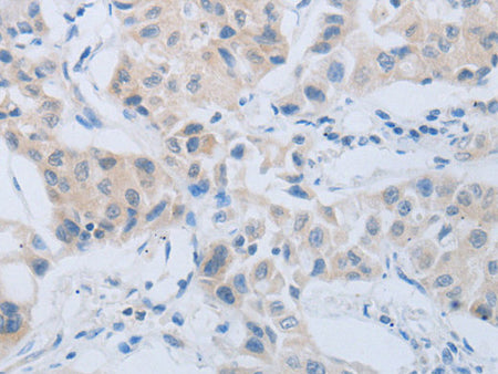 CD10 Polyclonal Antibody Store at -20°C