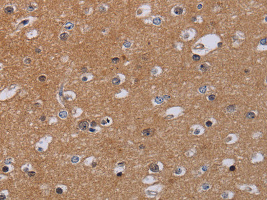 MKKS Polyclonal Antibody Store at -20°C
