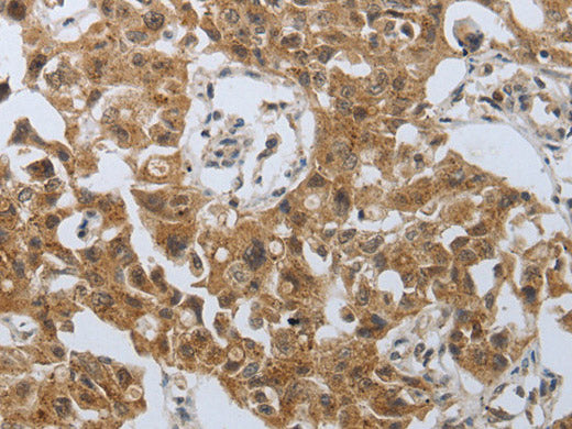 PSMD6 Polyclonal Antibody Store at -20°C
