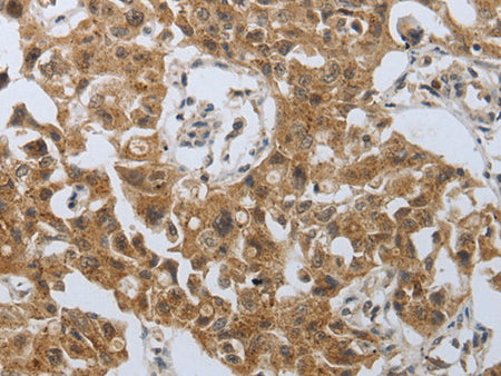 PSMD6 Polyclonal Antibody Store at -20°C