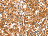 DAB2IP Polyclonal Antibody