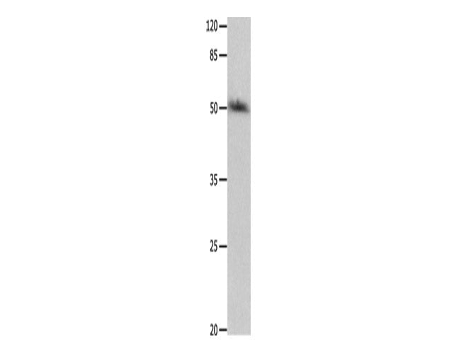 P2RY2 Polyclonal Antibody Store at -20°C