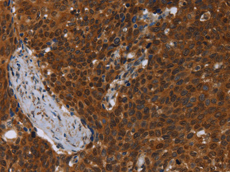 MCHR1 Polyclonal Antibody Store at -20°C