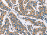 CAMK4 Polyclonal Antibody Store at -20°C