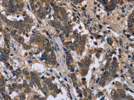 FRK Polyclonal Antibody Store at -20°C