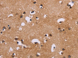 ERK1/2 Polyclonal Antibody