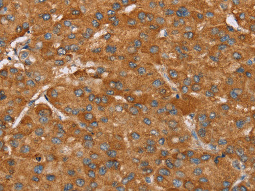 PAGE5 Polyclonal Antibody Store at -20°C